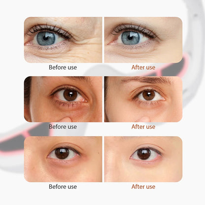 Masajeador de Ojos 3D EMS — Antifatiga Visual y Antiedad